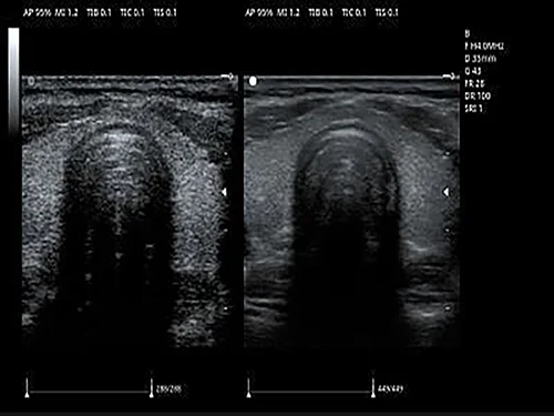 Spatial Composite Imaging